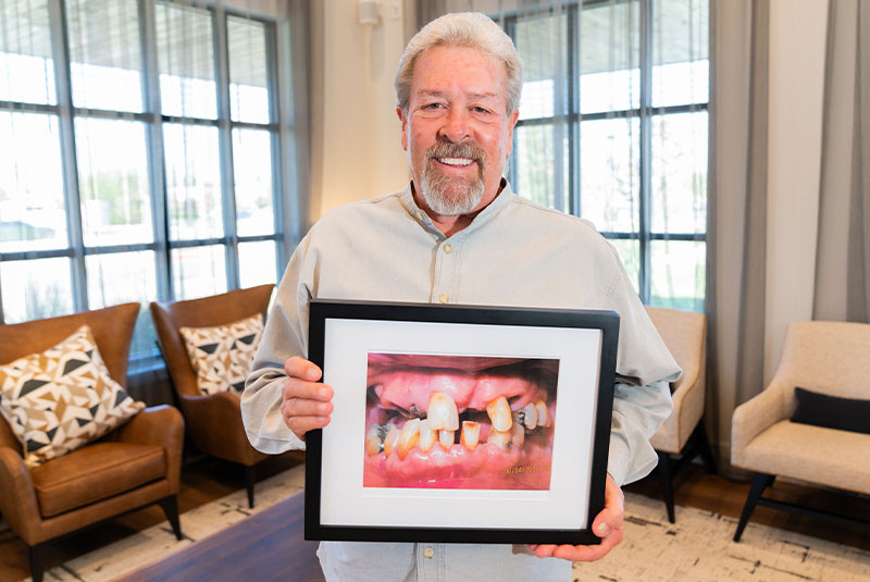 headshot of patient holding their before dental treatment within the dental center